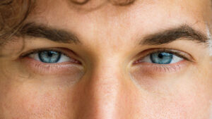 People With Blue Eyes Are More Likely To Develop This Medical Condition