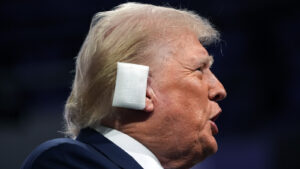 Could Donald Trump’s Ear Injury Cause Lasting Damage?